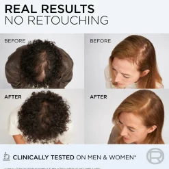 L'Oréal Paris Elvital Growth Booster Conditioner Against Hair Loss 150 Ml No Color Clearance